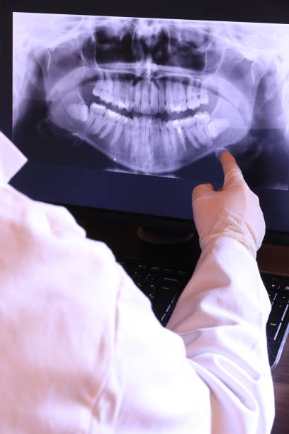 Best Emergency Dentist for Lost Fillings or Crowns in Laurens, IA